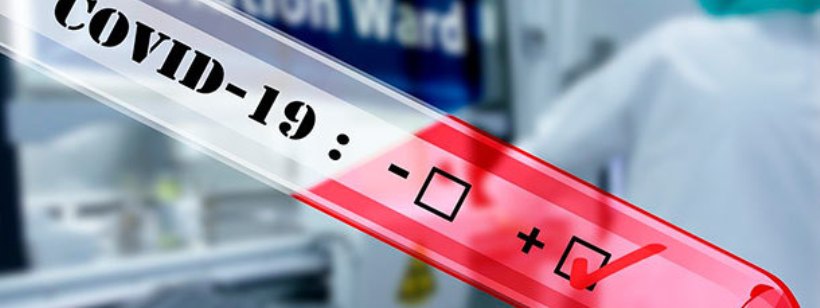 Тяжелый острый респираторный синдром коронавирус 2