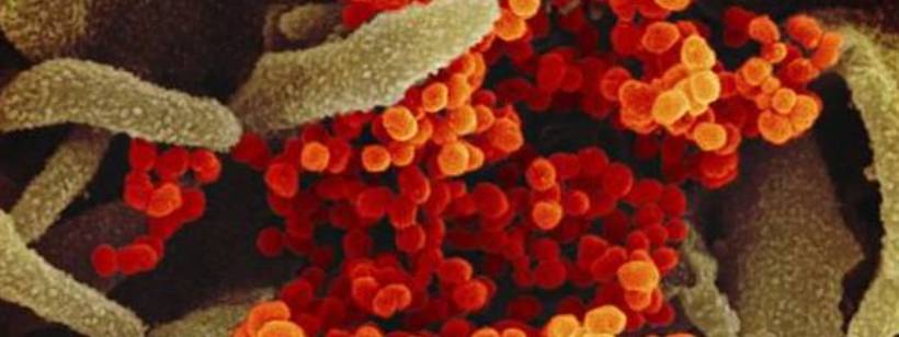 Пандемия коронавируса 2019?20