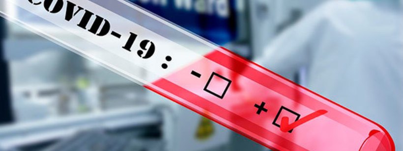 Тяжелый острый респираторный синдром коронавирус 2